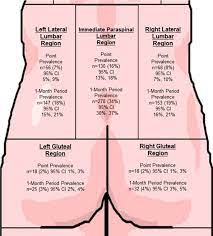 Jun 18, 2021 · the division of recreation resources provides parks and recreation grant, planning and technical assistance services to local governments in tennessee. Prevalence Of Low Back Pain By Anatomic Location And Intensity In An Occupational Population Bmc Musculoskeletal Disorders Full Text