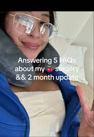 Aj Khalil Beverly Hills Before and After