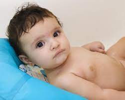 Skąd u anioła stróża myśli o. Uszczypniecie Bociana Jak Wyglada Co To Za Znamie I Czy Jest Grozne Dla Niemowlecia Mjakmama Pl