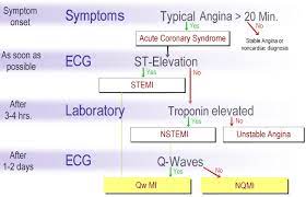 The unadjusted rates of all end points were lower for stemi patients compared with nstemi patients from 90 days to 2 years. Myocardial Infarction Heart Attack Stemi Vs Nstemi Lecturio