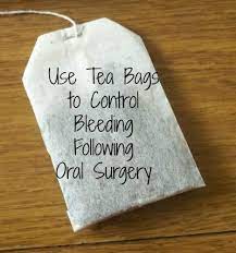Pin On Oral Surgery Lake Worth Florida
