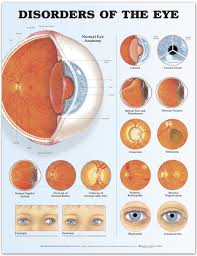 disorders of the eye chart poster laminated eye