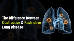 Lung Institute Obstructive Vs Restrictive Lung Disease
