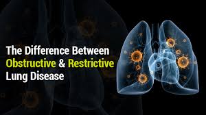 lung institute obstructive vs restrictive lung disease