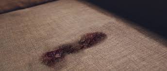 Blood Stains Out Of Your Upholstery