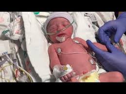 Weight depends on the diet u intake when u are pregnant healthy baby will of 9 to 10 pounds add this to your normal weight nothing more happy mother hood. Labor And Delivery At 34 Weeks Pregnant Emotional Youtube