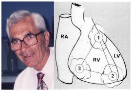 Frank Marcus and the triangle of right ventricular dysplasia with...