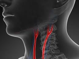 Arises from front of eca opposite the tip of greater cornu of hyoid bone. Carotid Arteries