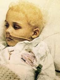 Nashville' star Clare Bowen overcomes scars from childhood cancer