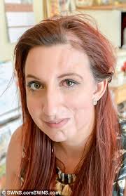yasmin butler whose face sunk says she