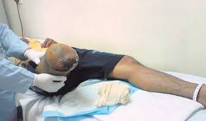 Cincin berlian tentu harganya sangat mahal dan jadi sebuah benda yang sangat berharga bagi pemiliknya. Kakiku Kudung