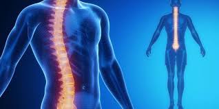 Check spelling or type a new query. Scoliosis Correction Surgery My Health Turkey