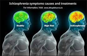 Malignant neuroleptic syndrome and febrile catatonia, extrapyramidal symptoms, electroconvulsive therapy, supportive therapy, pharmacological treatment. Schizophrenia Symptoms Causes And Treatments Dr Kapil Sharma