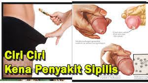 We did not find results for: Gambar Ciri Ciri Sipilis Pada Wanita Dan Pria Mengerikan Dan Cara Mengatasinya My Website Powered By Doodlekit