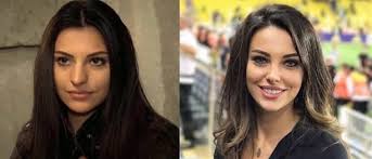 Benim eski burnumla üç başrolüm var. Tuvana Turkay Ve Alper Potuk Un Estetiksiz Hali Sasirtti