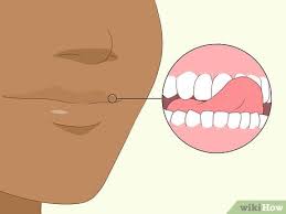 Try this one simple exercises to align your mouth and get rid of a crooked smile. How To Fix An Uneven Smile And Look Your Best