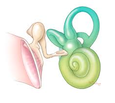 Image result for Ossicular Chain Disruption