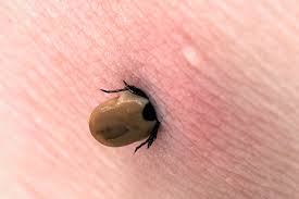 Do the following to remove a tick: Tick Bite Pictures Symptoms What Does A Tick Bite Look Like