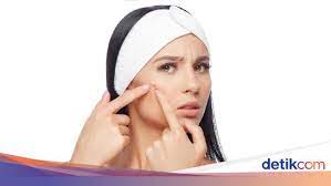 Cara Menghilangkan Jerawat Di Wajah Dengan Bahan Alami