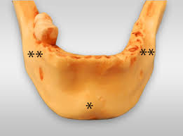 Adobe photoshop cc shake reduction. Chin Reduction Surgery Mentoplasty Chin Saving Explained Zukowski Center