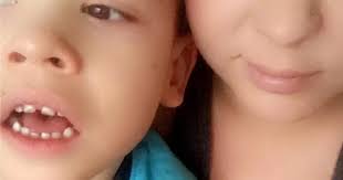 Little boy who can't sleep 'because he is in so much pain' has to have  Botox injections in his legs