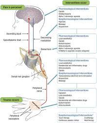 Multimodal Pain Management And The Future Of A Personalized Medicine Approach To Pain Manworren 2015 Aorn Journal Wiley Online Library