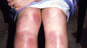 Pin On My Health 2020