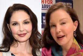 She was voted as one of the '25 most intriguing people' by 'people' magazine and was also ranked at number 20 on the 'fhm' magazine's list of 'sexiest women in the world'. Ashley Judd E Criticada Na Web Por Rosto Inchado Quem E O Cirurgiao Quem Quem News