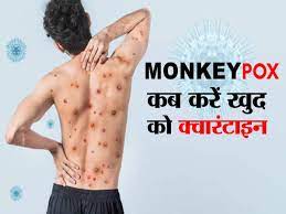 What is Monkeypox in Hindi