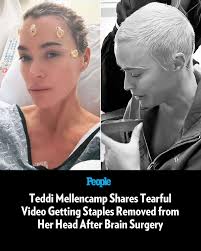 🔗: bit.ly/41yUZEw Teddi Mellencamp is sharing a look at an emotional  moment as she recovers from brain surgery. 📷️: Teddi Mellencamp/Instagram  (2)