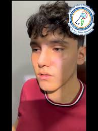 Antes y después de pacientes Valoraciones +57 310 882 6919 #viraltikt...