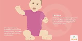 Infection is spread from person to person by direct contact with nose and throat discharges or oral fecal contamination—which might sound like your. Coxsackie Tanda Dan Gejala Penyebab Cara Mengobati Cara Mencegah