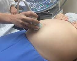 Primeiros Sintomas De Gravidez Como Saber Se Estou Gravida