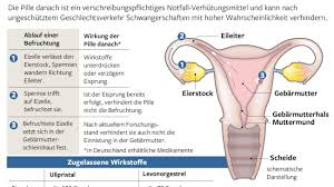 Ein einnistung rechner ermittelt dir das ergebnis auch anhand des letzten tages. Verhutungsmittel Pille Danach Sturmlauf Gegen Minister Grohe Welt