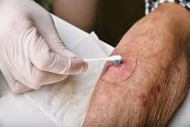 Image result for Skin Trauma