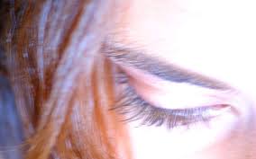 Maybe you would like to learn more about one of these? Ptosis Quels Sont Les Causes Symptomes Et Traitements