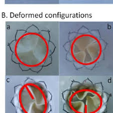 I think for a good test coverage you need anyway both of them though. Pdf An In Vitro Feasibility Study Of The Influence Of Configurations And Leaflet Thickness On The Hydrodynamics Of Deformed Transcatheter Aortic Valve