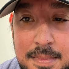 Fundraiser by Juan Lima : Emergency Eye Surgery