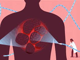 Https Encrypted Tbn0 Gstatic Com Images Q Tbn 3aand9gcqyxpe15egiqxxrrcyzlqplls2ikz32ukdpwq Usqp Cau