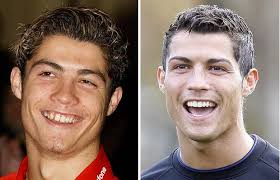 Cristiano ronaldo cleans the street | كريستيانو رونالدو ينظف الشارع. Smile Makeover 1 Cristiano Ronaldo Mint Dental