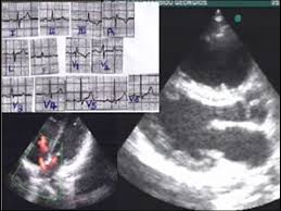 We've got 11 questions—how many will you get right? Cardiology Trivia Detailed Login Instructions Loginnote