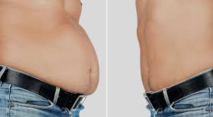 At vi burde utsette bryllupet til etter fødselen. Slik Kvitter Du Deg Med Det Farlige Magefettet Underholdning