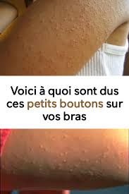 Pin On Trucs Et Astuces