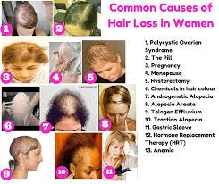 More specifically, baldness is associated with iron deficiency. How To Stop Hair Loss Thing You Need To Follow Tikkay Khan