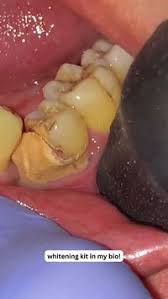 Paola Lara Coronado (paolalaracoronado)