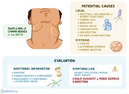 Inflamed lymph nodes themselves are generally not a major concern, but if you have symptoms of another condition along with enlarged lymph nodes children tend to have a more active lymphatic system, so their nodes may feel enlarged. Cervical Lymphadenopathy What Is It Causes Workup Treatment And More Osmosis