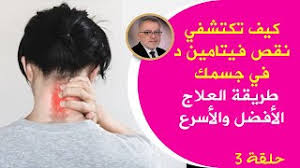 كنز جعله الله علاج دوالي الساقين ويشفي بسرعة، يقدم الدكتور مازن السقا طرق طبيعية لمحاربة الأوردة. Ø®Ø·Ø£ ÙŠÙ‚Ø¹ ÙÙŠÙ‡ Ø§Ù„Ù…Ù„Ø§ÙŠÙŠÙ† Ø£Ø«Ù†Ø§Ø¡ ØªØ¨ÙŠÙŠØ¶ Ø§Ù„ÙˆØ¬Ù‡ ÙˆØ§Ù„Ø¬Ù„Ø¯ ÙÙŠ Ø§Ù„Ù…Ù†Ø²Ù„ ÙˆØµÙØ© Ù„Ø¨Ø´Ø±Ø© Ø£ÙƒØ«Ø± Ù†Ø¸Ø§ÙØ© Ù†Ø§ØµØ¹Ø© Ø¨Ø´ÙƒÙ„ Ù…Ø³ØªÙ…Ø± ÙˆØ¯Ø§Ø¦Ù… Invidious