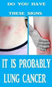 One of the first areas to be impacted: Pin On Women Health And Beauty Tips