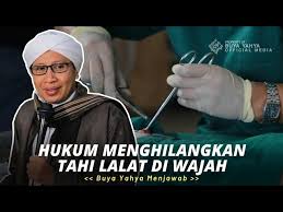 Are you see now top 20 hukum buang tahi lalat ustaz azhar idrus results on the my free mp3 website. Hukum Menghilangkan Tahi Lalat Di Wajah Buya Yahya Menjawab Youtube