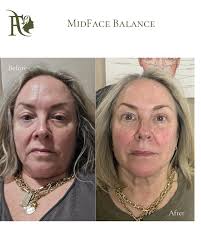 Flawless Medical Aesthetics